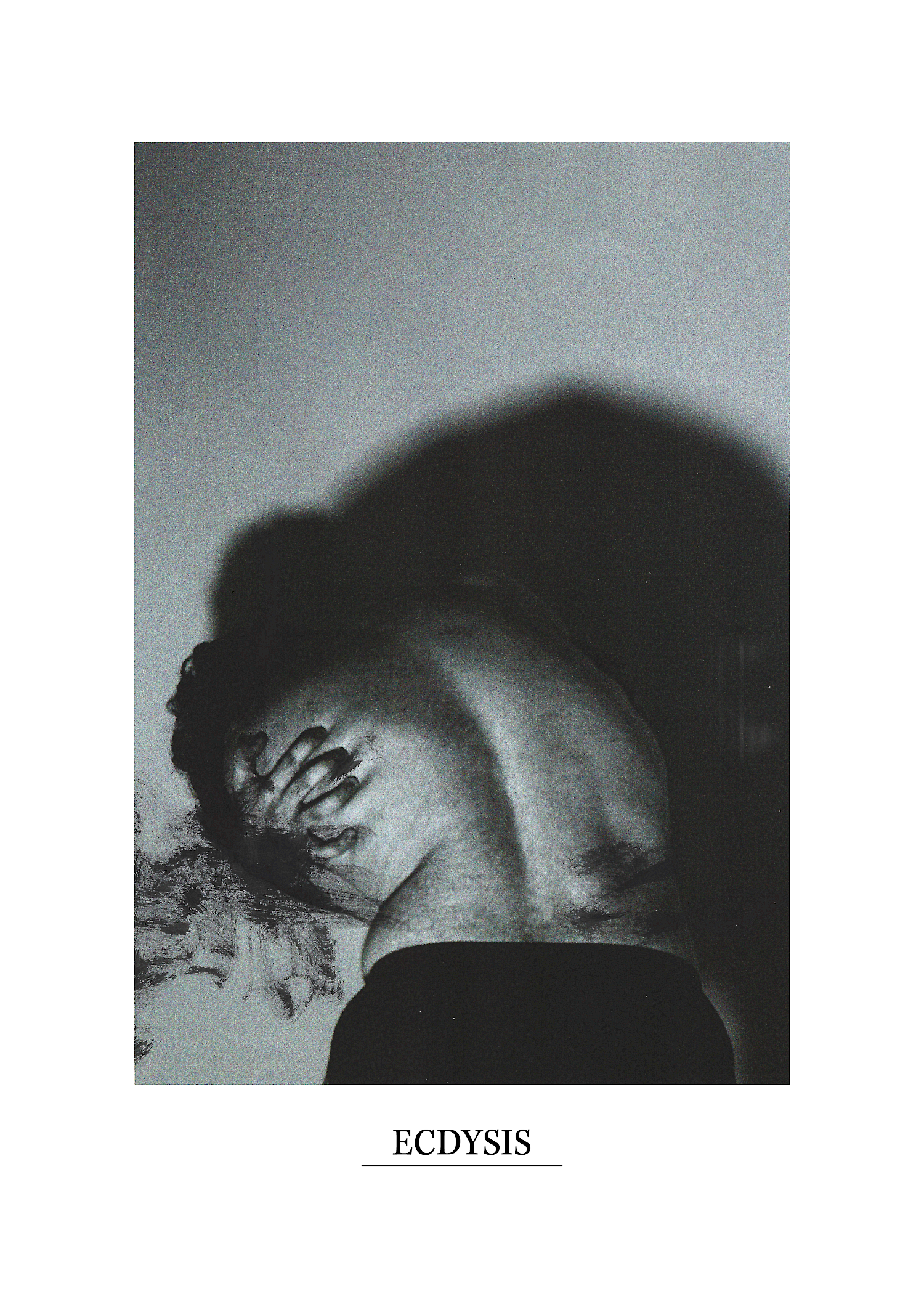 ECDYSIS; A very personal project, surrounding my experience with Topical Steroid Withdrawl & severe dermatitis. Included a self-shot photoshoot, were the imagery was printed, scratched into, drawn on, and then rescanned to create layers of texture. These are a select few of the intense imagery that was hand bound into a publication, and then torn apart to become an artefact.I shed my skin. ECDYSIS; A very personal project, surrounding my experience with Topical Steroid Withdrawl & severe dermatitis. Included a self-shot photoshoot, were the imagery was printed, scratched into, drawn on, and then rescanned to create layers of texture. These are a select few of the intense imagery that was hand bound into a publication, and then torn apart to become an artefact.I shed my skin.